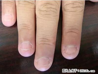 剪指甲、挖耳屎，这些日常小动作竟隐藏大危害！ - 温州生活资讯 - 温州28生活网 wz.28life.net